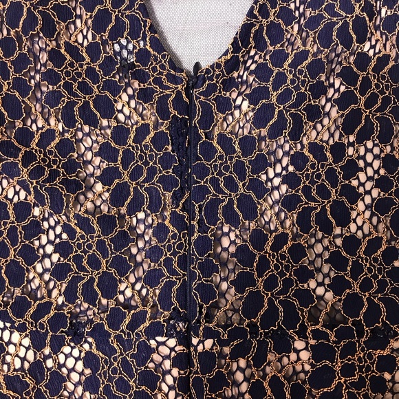 ASTR Blue & Gold Lace Peplum Top - Picture 8 of 10